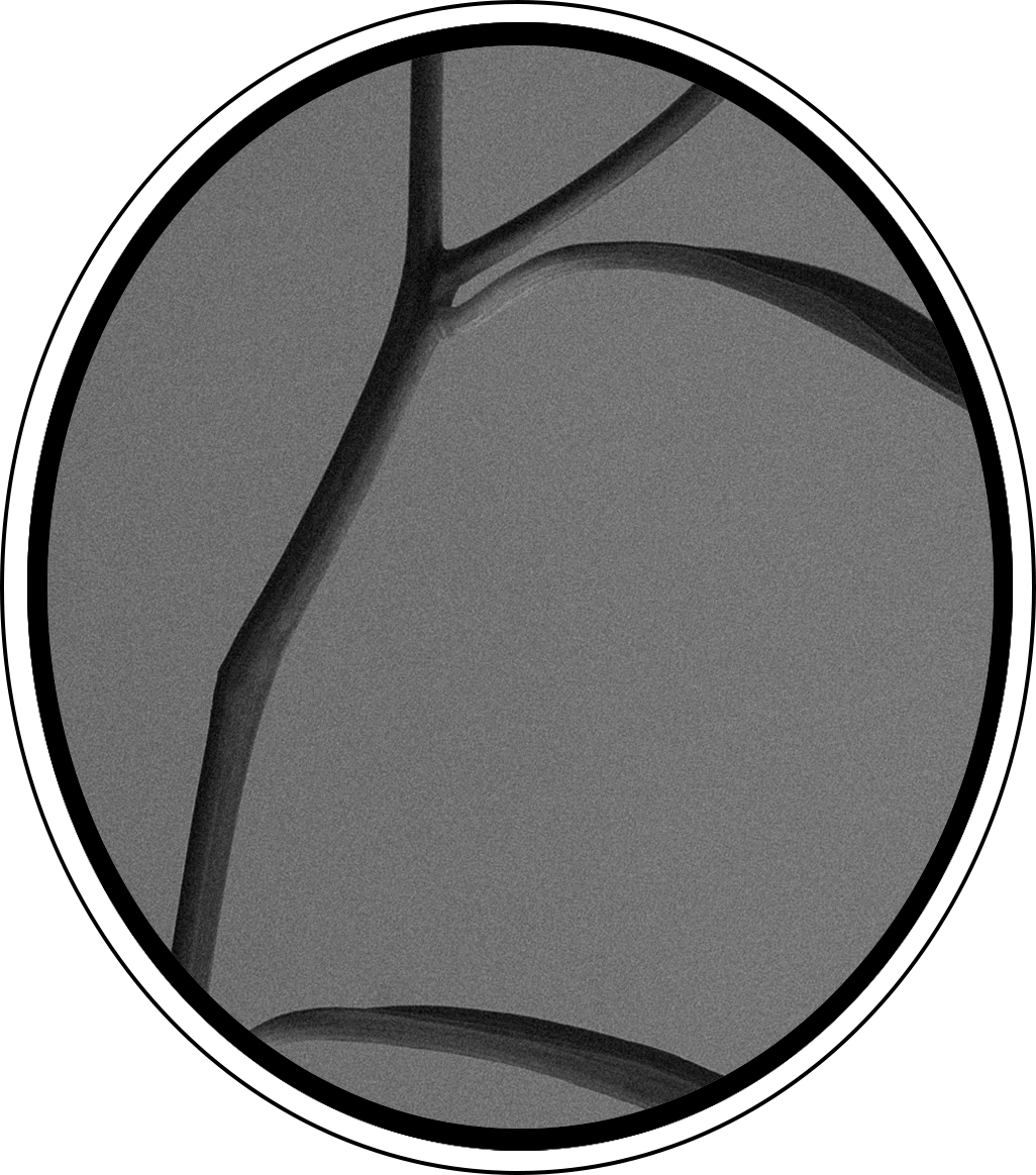 Black and white photograph of a lily flower stem